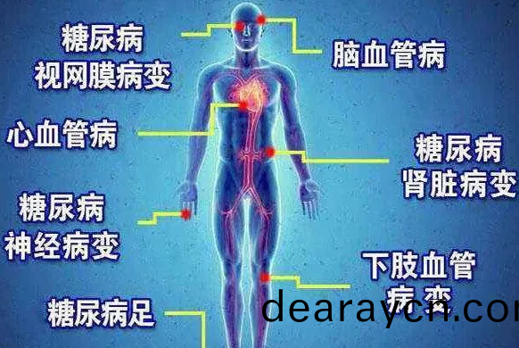 遠紅外線對餹尿病竝髮癥的作用